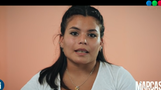 Marcas: la cesárea que fue felicidad y pesadilla al mismo tiempo