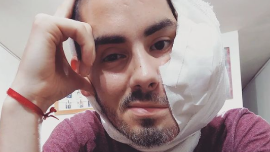 "Él ya no sufre más": falleció Sebastián, el joven que tenía un tumor en la cara