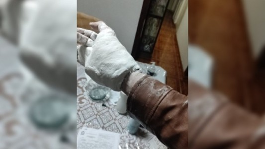 Chocó con la moto, le pusieron un yeso y ahora no se puede sacar la campera