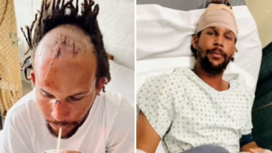 "Le abrí la boca, saqué mis dedos y cayó": un cocodrilo le atrapó la cabeza cuando pescaba bajo el agua