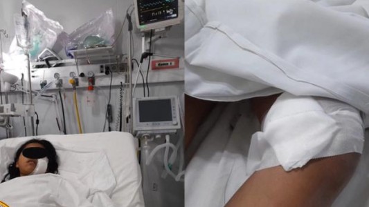 El relato de la nena apuñalada en un intento de robo: "Un señor me preguntó si tenía celular"