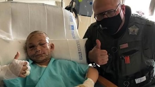 Nena de 9 años sobrevivió al ataque de un puma: su familia pide ayuda