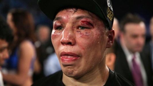 Así quedó el rival de Lucas Matthysse tras la terrible pelea