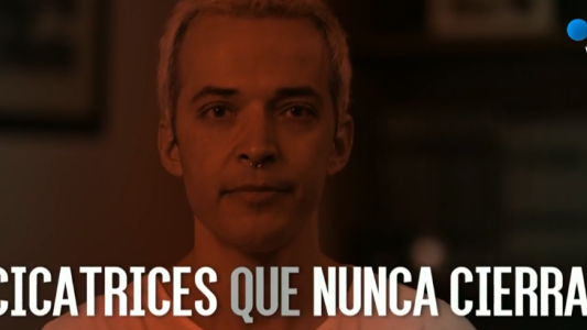 Marcas: la historia de Thiago y el trasplante que le salvó la vida