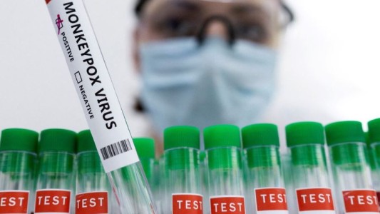 Confirmaron el quinto caso de viruela del mono en la Argentina