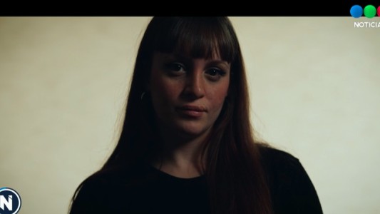 Marcas: la historia de Mariana y su "marca" de nacimiento