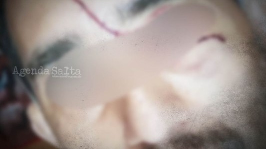 Una mujer le cortó la cara a su ex pareja con un cuchillo porque inició una nueva relación