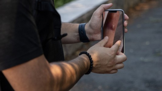 "No le deseo a nadie lo que pasé": habla un hombre recién recuperado de la viruela del mono