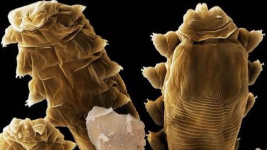Los ácaros microscópicos que viven en nuestra cara
