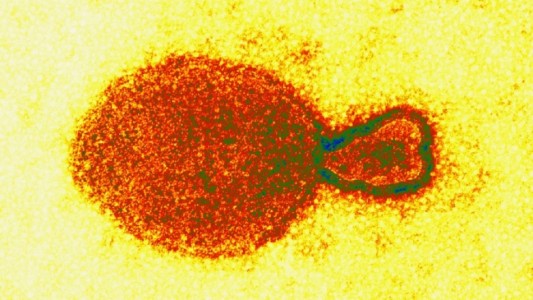 China registra 35 pacientes contagiados con nuevo virus derivado de animales: cuáles son los síntomas