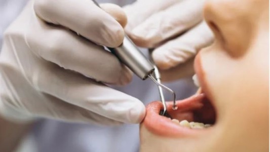 Los dientes y prótesis en mal estado aumentan el riesgo de cáncer bucal