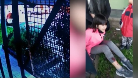 Un pitbull salió a la calle, atacó a una nena y mató a su perro caniche