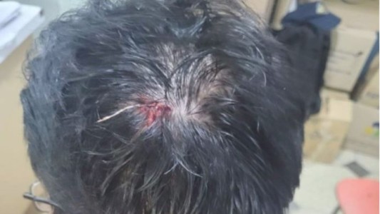 Trelew: un taxista agredió a un operario con una llave de auxilio