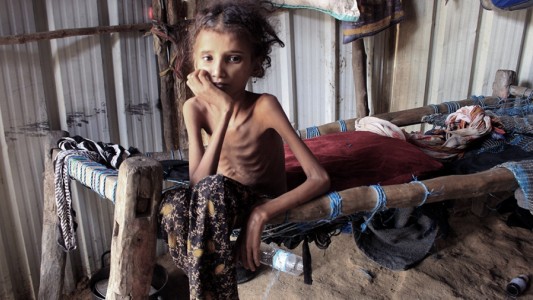 Cada cuatro segundos muere una persona de hambre en el mundo