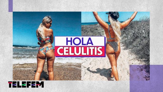 Hola Celulitis #Telefem
