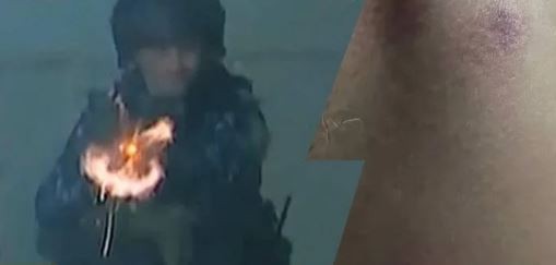 El testimonio del camarógrafo herido por la Policía: "Fue para sacarme de escena"