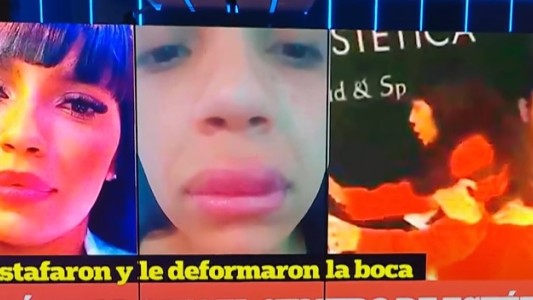 Escándalo en el centro de estética: le deformaron el labio, fue a reclamar y le pegaron