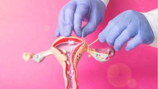 Mendoza: impulsan un proyecto que busca evitar embarazos a través de ligadura de trompas y vasectomía