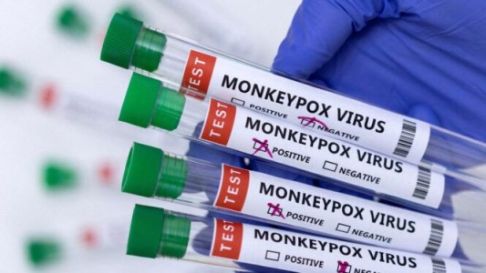 Viruela del mono en Argentina: confirman el primer caso infantil y la primera internación en terapia intensiva