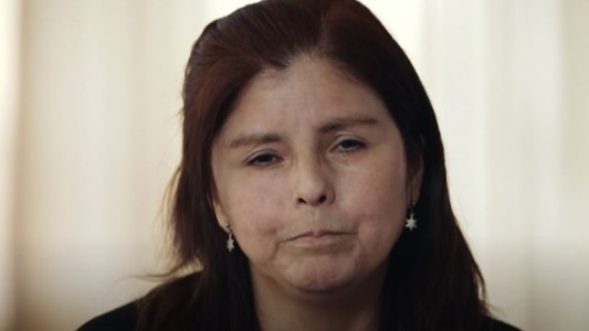 Marcas: Yolanda, una mujer marcada por la esclerosis difusa