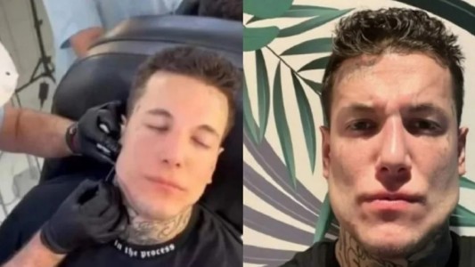 "Me ven en persona y se les cae la bombacha": Alex Caniggia, furioso por las críticas sobre su mandíbula