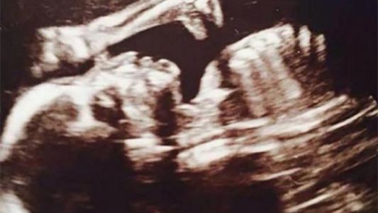 Hallaron un dinosaurio en una ecografía de bebé