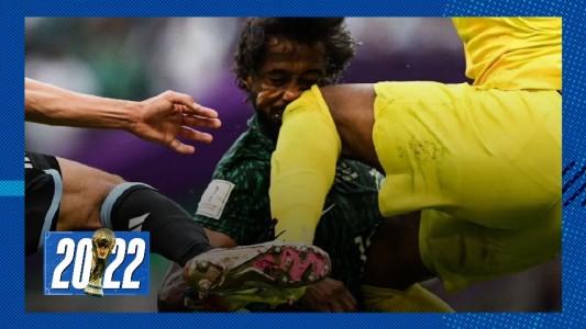 Fractura de mandíbula y cráneo, la terrible lesión del defensor de Arabia Saudita