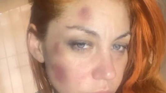 Lourdes, ex cantante de Bandana, denunció a su ex pareja por violencia de género