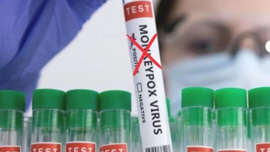 Cambiaron el nombre a la viruela del mono por considerarlo un "lenguaje racista y estigmatizante"