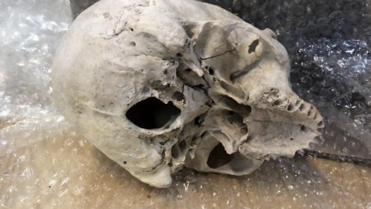 Una calavera y una factura por 295 dólares: el misterio en un encomienda secuestrada por la Aduana