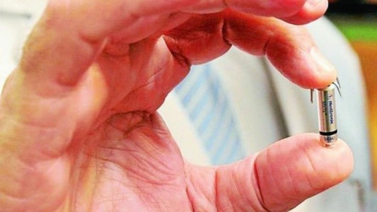 El Hospital Posadas realizó el primer implante de marcapasos sin cable en el país