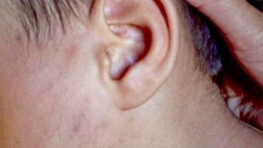 Denuncian a padres por "lesiones graves" a su hijo de 4 años en Santiago del Estero