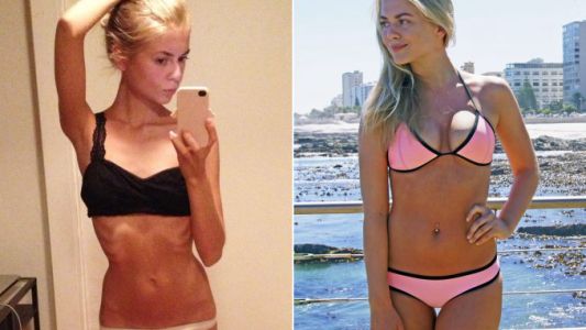 Una chica cuenta su pelea contra la anorexia a través de Instagram