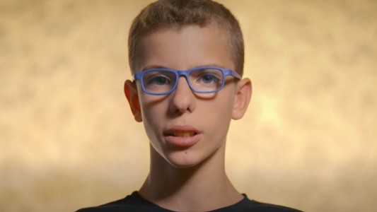 Marcas: Ale, el chico que superó una enfermedad de nacimiento