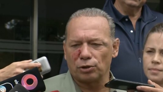 Tras ser agredido, Berni habló sobre el crimen del colectivero: "No es un hecho habitual"