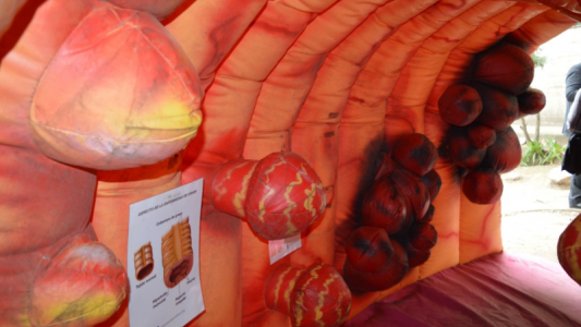 Instalan un colon inflable gigante para concientizar sobre la prevención del cáncer colorrectal