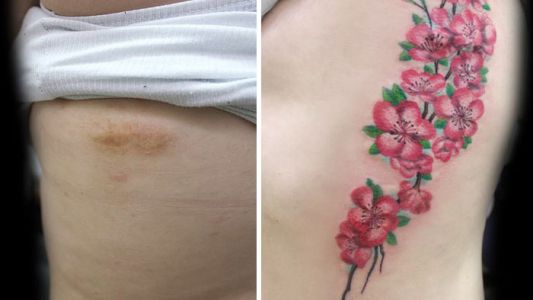 La historia de la artista que hace tatuajes sobre cicatrices de mujeres que sufrieron violencia de género