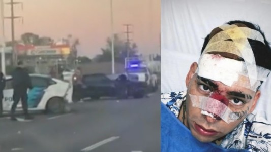 Kaleb Di Masi chocó contra un patrullero: creen que corría una picada