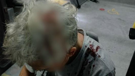 Línea 161: le pegaron un culatazo a una pasajera durante un asalto