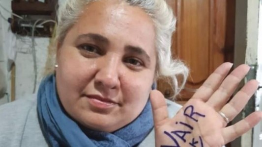 Murió la concejal de Quilmes que había sufrido graves quemaduras tras una discusión de pareja