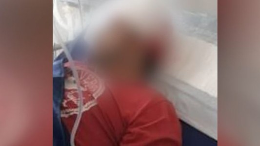 Agredieron a un chofer de la línea 180: le arrojaron un ladrillo