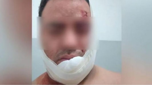 Violento robo a un taxista de ladrones que se hicieron pasar por pasajeros: “Me cortaron el cuello”
