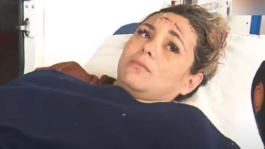 Fue baleada en la cabeza y se hizo la muerta para que no la maten