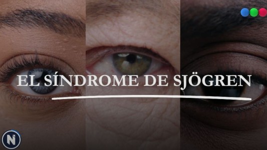 El síndrome de Sjögren: "No podemos llorar porque no generamos lágrimas"