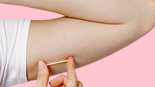 Anticoncepción: colocarán implantes subdérmicos a mujeres mayores de 20 años en Salta