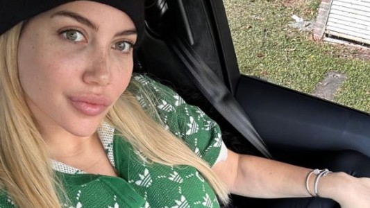 Wanda Nara habló de su salud: "Lo mantendré en mi intimidad"