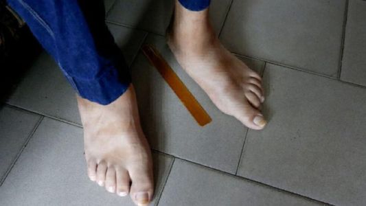La historia del hombre con los pies más grandes del mundo