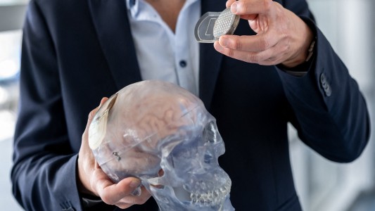 Implantes cerebrales: la carrera hacia el cíborg cobra impulso