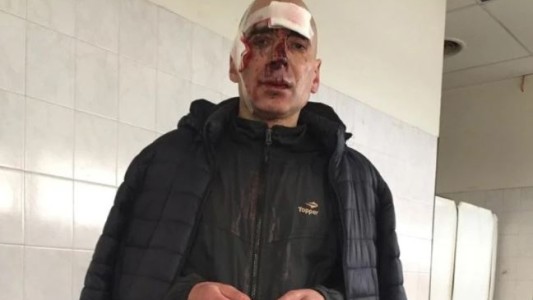 Dos motociclistas golpearon salvajemente a un maratonista: "Fueron directamente a matarme"