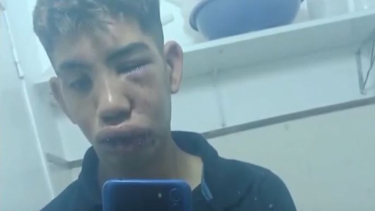 Brutal golpiza a un joven en Casilda por una pelea de tránsito: "Podrían haberme matado"